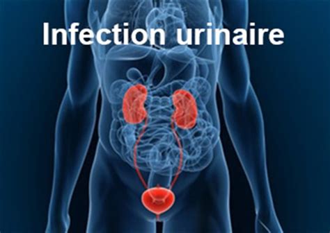 sodomie et infection urinaire|Peut